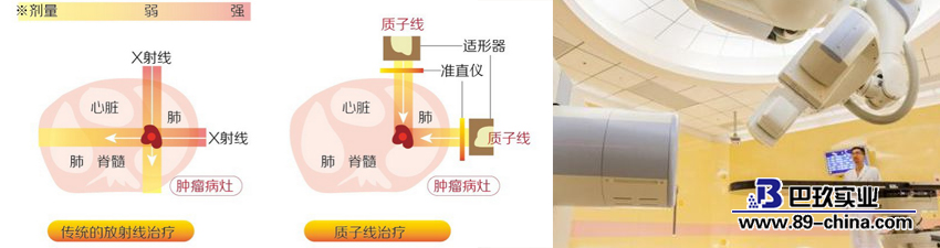 質子重離子治療癌癥示意圖